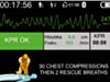 ECG-Weergave