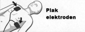 Plaatsing Primedic HeartSave elektroden