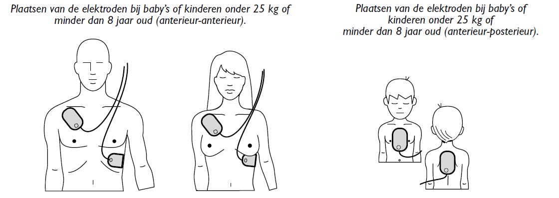 Platsing elektroden FRx