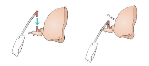 Laerdal Baby Anne Luchtwegen